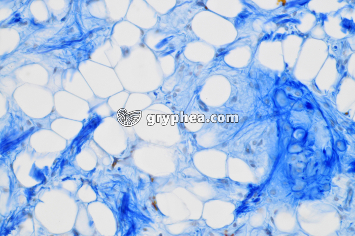 Epiglotte x100 - gryphea.com